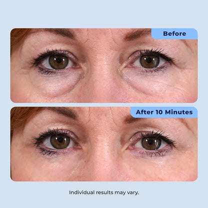 Plexaderm Rapid Reduction Serum