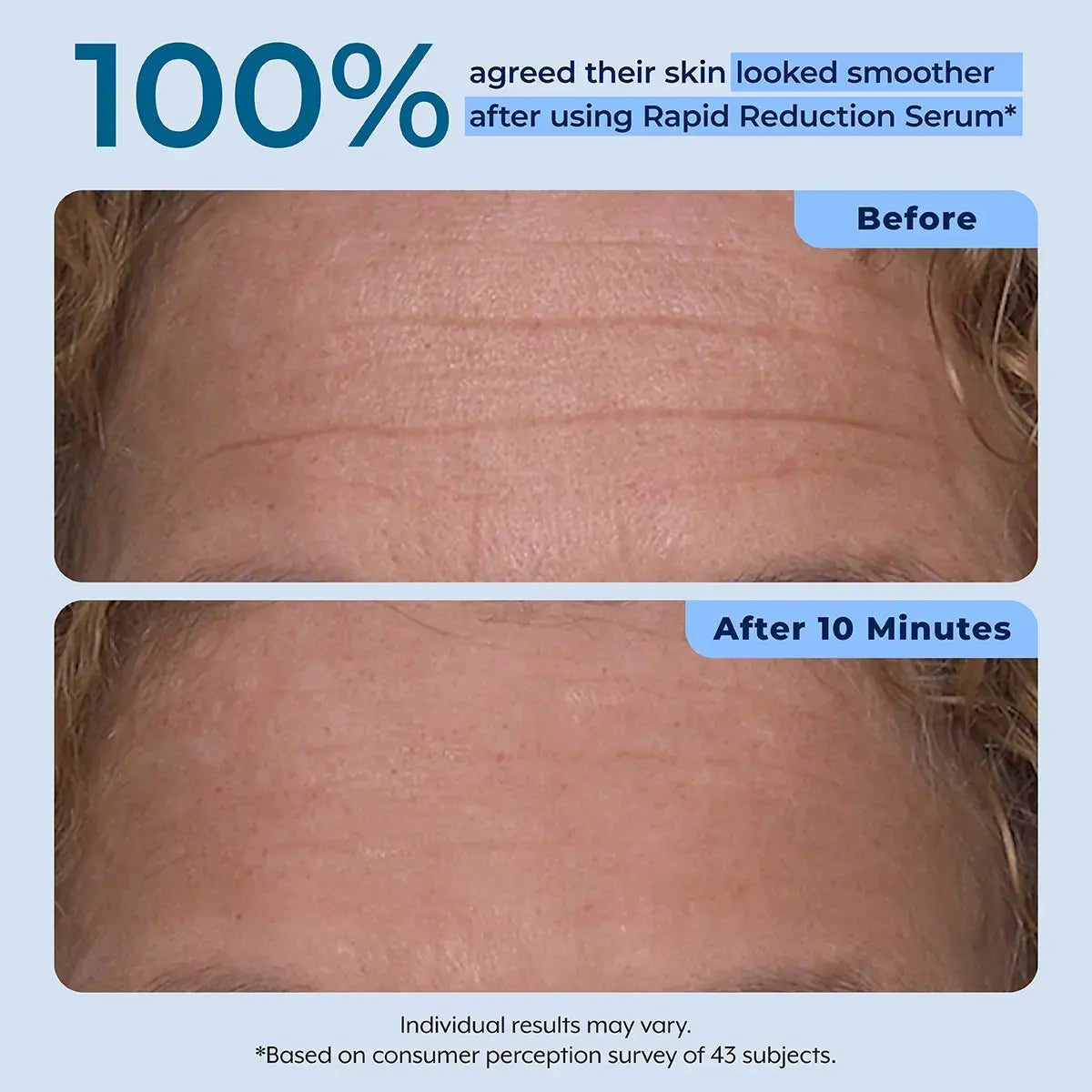 Plexaderm Rapid Reduction Serum