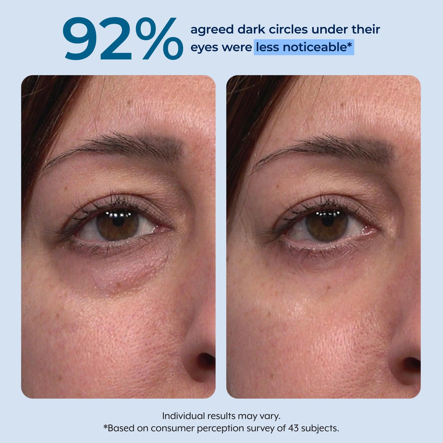 Plexaderm Rapid Reduction Serum