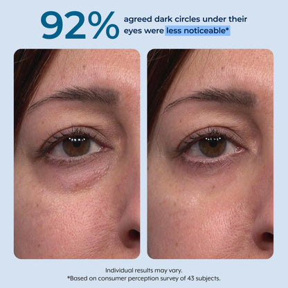 Plexaderm Rapid Reduction Serum