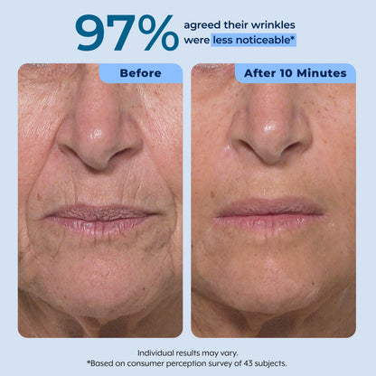 Plexaderm Rapid Reduction Serum